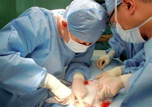 女人打过胎看这处就知道 痕迹可能伴随一生