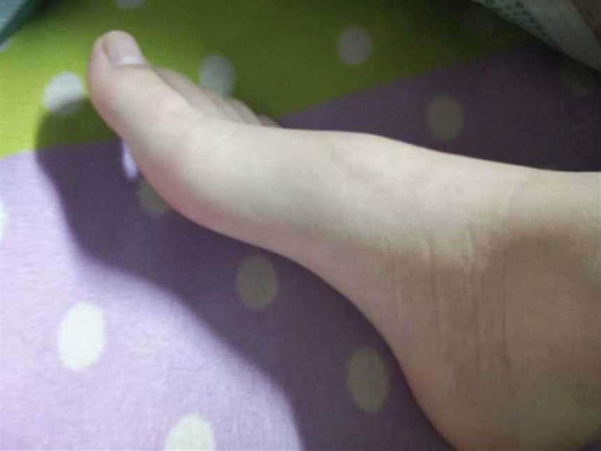 足弓有平滑的曲线则美,反之扁平足丑丑的.