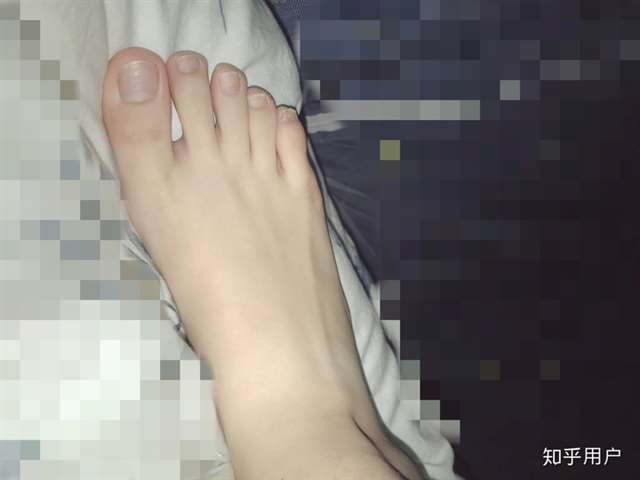 我基友说我jiojio丑,但我觉得我白就好惹