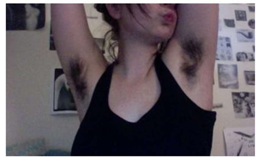 &gt;&gt; 正文    原标题:女性养生:女人体毛加重 警惕卵巢疾病   女性多毛