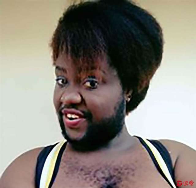 非洲多毛女 浓密胡须胸毛似男人_读特新闻客户端