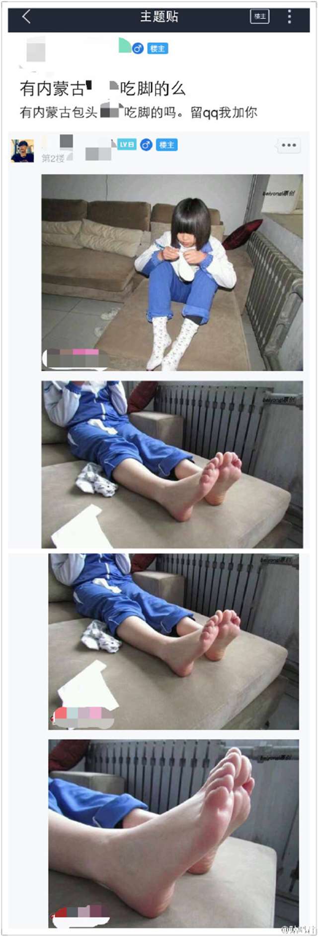 恋足癖患者对足部的执着是你无法想象的