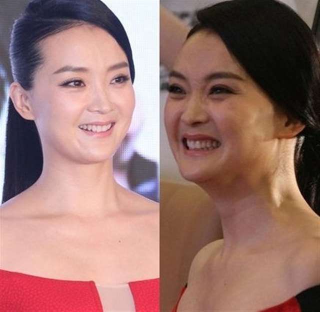 张惠妹再变胖夺人眼球 悉数中年发福女明星