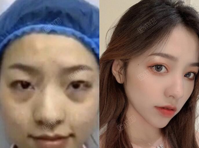 抖音刘思瑶nice整过容吗，“整容”素颜照片扒出，网友直呼被“照骗”欺骗