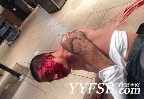 网上流传IR刘一手被打的头破血流现场图片