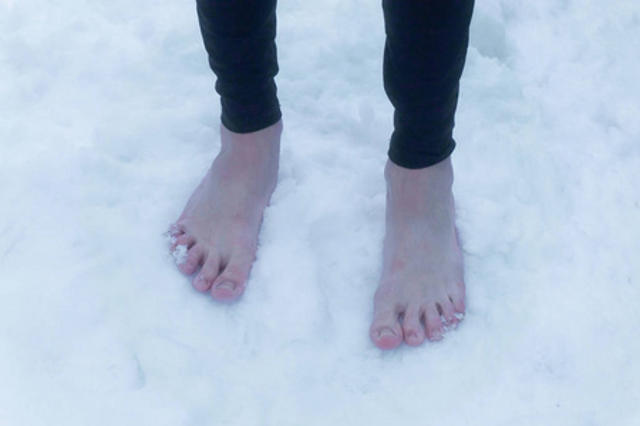 雪地里冻红的赤脚公脚照片